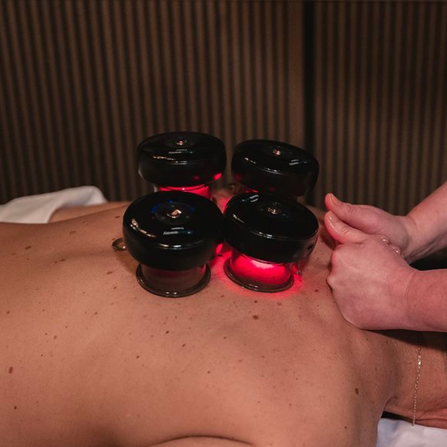 Smart Recovery Cupping Device