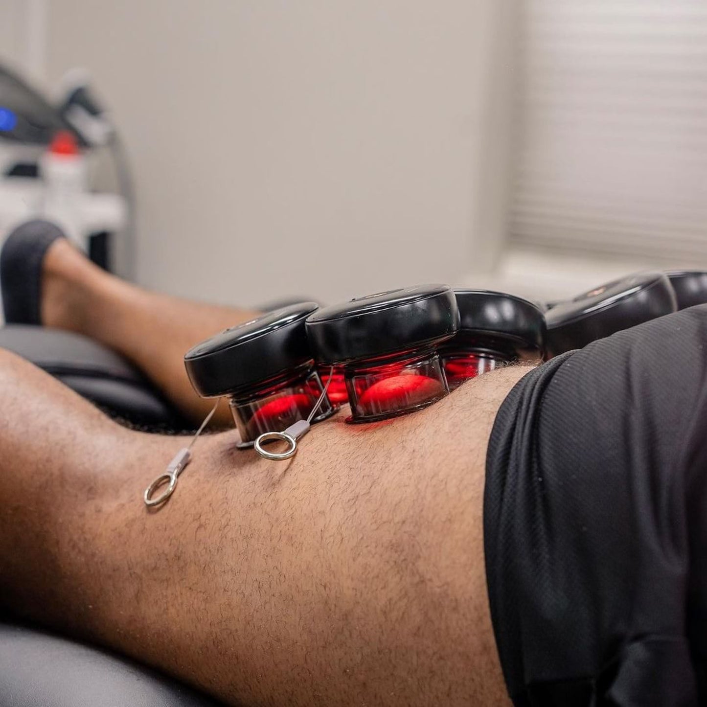 Smart Recovery Cupping Device